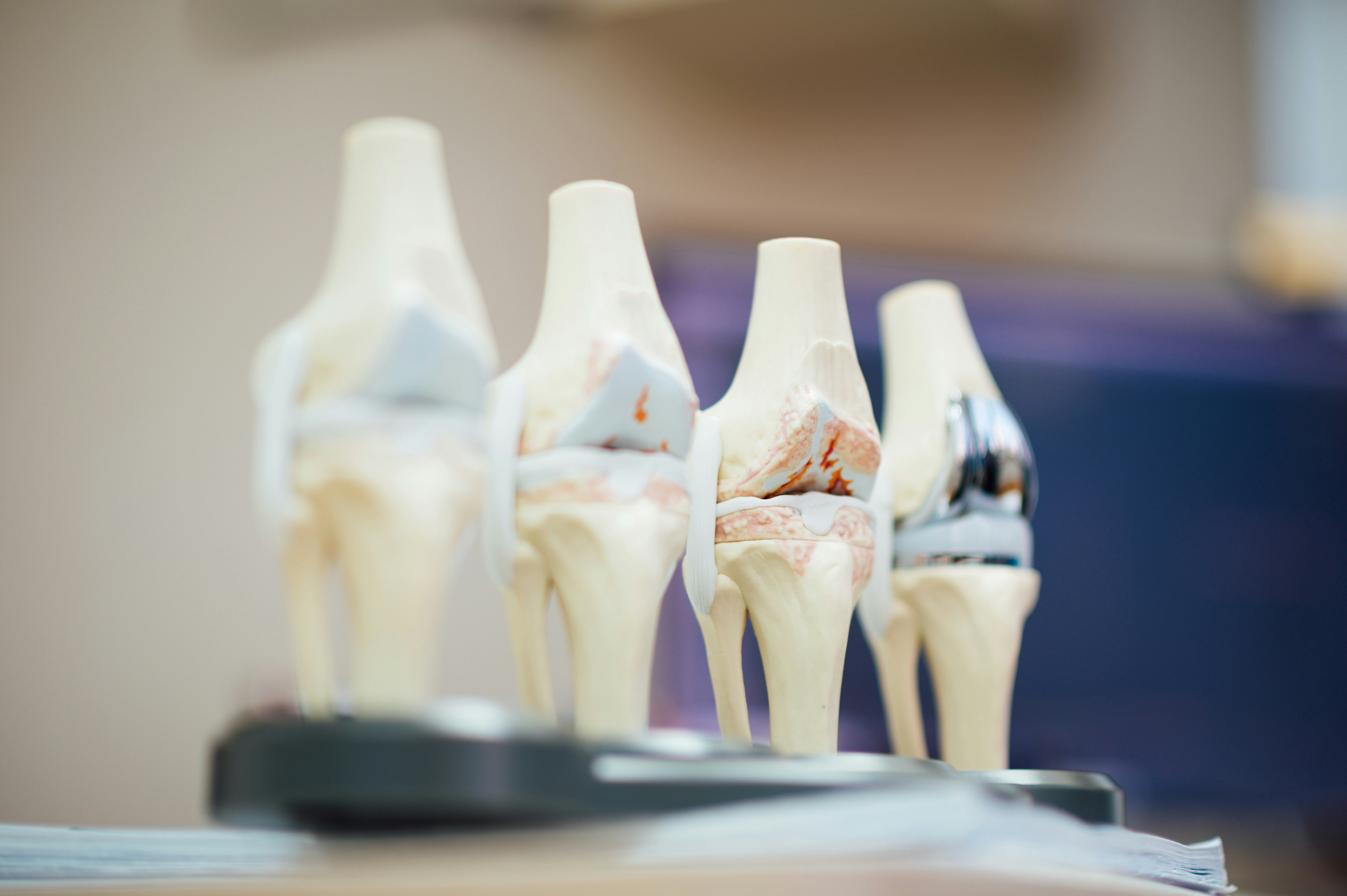 Orthopaedic Implants